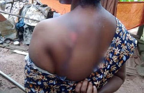 യുവതിക്ക് മിന്നലേറ്റു/ ടെലിവിഷൻ സ്ക്രീൻഷോട്ട്