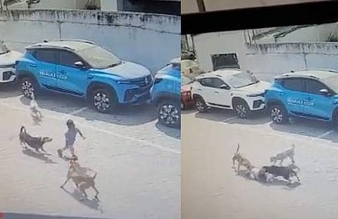 നാലു വയസ്സുകാരനെ നായ്ക്കള് ആക്രമിക്കുന്നു/ വിഡിയോ ദൃശ്യം
