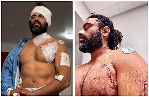 ആക്രമണത്തില് പരിക്കേറ്റ നടന്/ ട്വിറ്റര്