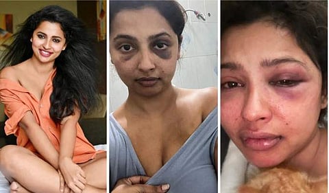 നടി അനിഖ വിക്രമന്