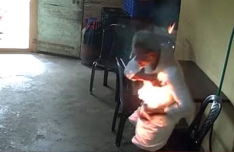 പോക്കറ്റിൽ കിടന്ന മൊബൈൽ ഫോൺ പൊട്ടിത്തെറിക്കുന്ന ദൃശ്യം