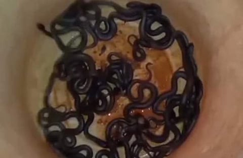 വാവ സുരേഷ് പിടികൂടിയ മൂര്ഖന് കുഞ്ഞുങ്ങള്, സ്ക്രീന്ഷോട്ട്