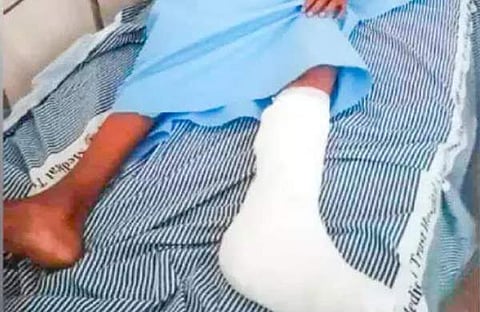 കാലിന് പരിക്കേറ്റ മിലൻ സാമുവൽ