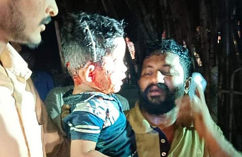 പുലി ആക്രമണത്തില് പരിക്കേറ്റ മൂന്നുവയസുകാരന്/ ട്വിറ്റര്