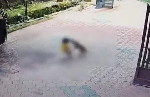 കുട്ടിയുടെ മുഖത്ത് തെരുവുനായ കടിക്കുന്നതിന്റെ സിസിടിവി ദൃശ്യം