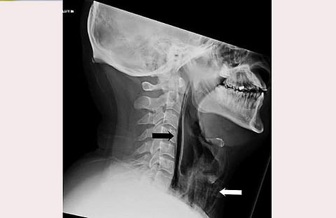 ബിഎംജെ കേസ് റിപ്പോര്ട്ട്സ് എക്സില് പങ്കുവെച്ച ചിത്രം
