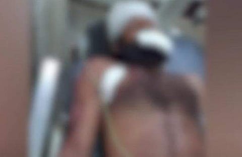 പരിക്കേറ്റ രാജേഷ് ആശുപത്രിയിൽ/ ടിവി ദൃശ്യം