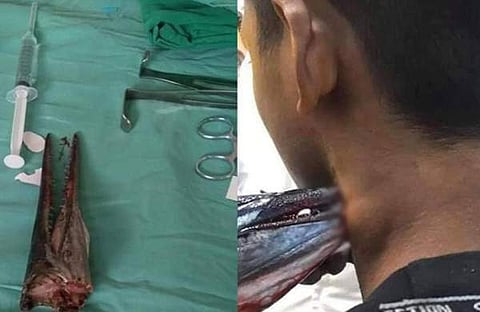 യുവാവിനെ കുഴല ആക്രമിച്ചു/ എക്സ്