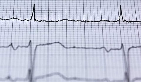 ഫയല് ചിത്രം