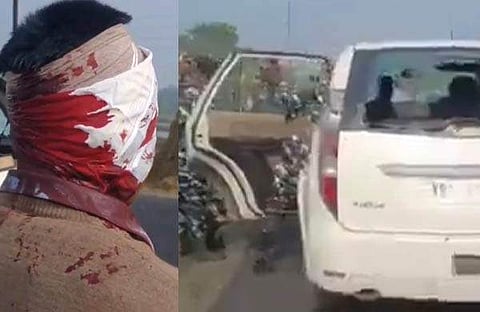 ബംഗാളില് ഇഡി സംഘത്തിന് നേരെയുണ്ടായ ആക്രമണം