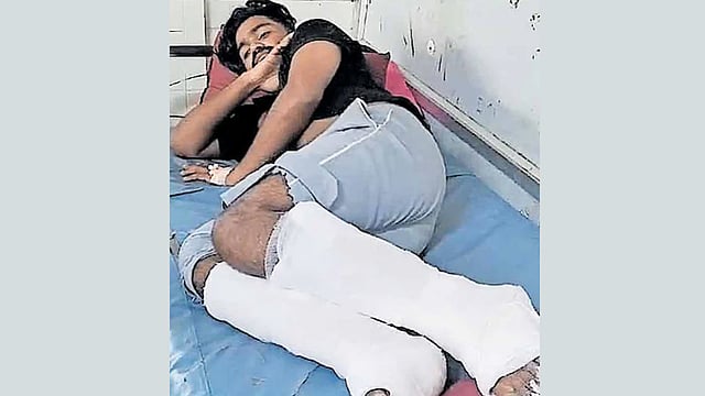 സിഐടിയു ആക്രമണം ഭയന്ന് ഓടി: കെട്ടിടത്തിൽ നിന്ന് ചാടിയ തൊഴിലാളിയുടെ കാലൊടിഞ്ഞ സംഭവത്തിൽ 10 പേർക്കെതിരെ കേസ്