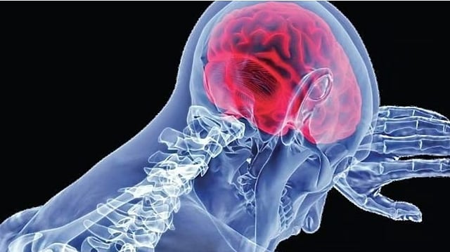amoebic encephalitis