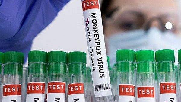 വിദേശത്തു നിന്നും ഇന്ത്യയിലെത്തിയ യുവാവിന് മങ്കിപോക്‌സ് ലക്ഷണം; നിരീക്ഷണത്തില്‍