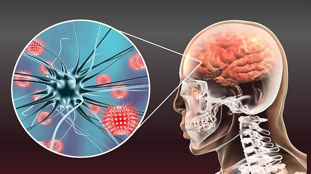 amoebic meningoencephalitis