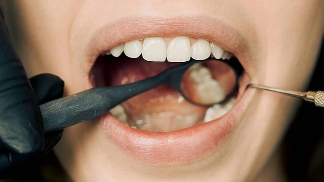 oral cancer