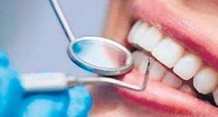 പല്ല് മാറ്റിവെക്കൽ ശസ്ത്രക്രിയയിൽ പിഴവ്, പരാതിക്കാരന് ഒരു ലക്ഷം ദിർഹം നഷ്ടപരിഹാരം നൽകാൻ ഉത്തരവിട്ട് കോടതി