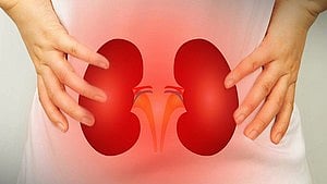KSOTTO to promote swap kidney transplant