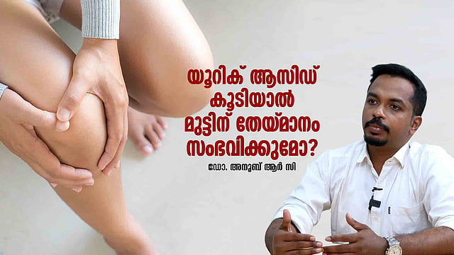 യൂറിക് ആസിഡ് കൂടിയാല് മുട്ടിന് തേയ്മാനം സംഭവിക്കുമോ? റെഡ് മീറ്റ് കഴിക്കുന്നവര് സൂക്ഷിക്കുക