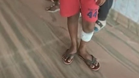 രണ്ടാനച്ഛന്റെ ക്രൂരത; എട്ടുവയസ്സുകാരനെ തേപ്പുപെട്ടികൊണ്ട് പൊള്ളിച്ചു; കസ്റ്റഡിയില്