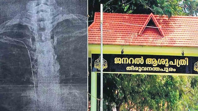 'പരാതി ലഭിക്കും മുന്പ് അന്വേഷണം നടത്തി', യുവതിയുടെ നെഞ്ചില് ട്യൂബ് കുടുങ്ങിയ സംഭവത്തില് ആരോഗ്യ വകുപ്പ്, ഒഴിഞ്ഞുമാറി മന്ത്രി