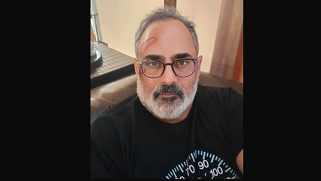 ട്രെഡ് മില്ലില്‍ നിന്ന് വീണ് രാജീവ് ചന്ദ്രശേഖരന് പരിക്ക്; അപകടം മൊബൈല്‍ ഫോണ്‍ എടുക്കാന്‍ ശ്രമിക്കുന്നതിനിടെ