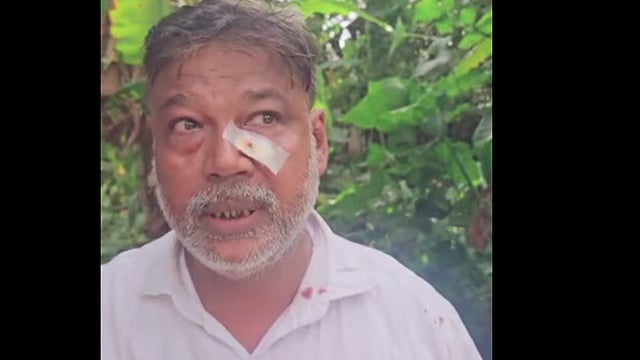 വീണ്ടും ആക്രമണം; ഐലന്‍ഡ് എക്‌സ്പ്രസില്‍ ഭിന്നശേഷിക്കാരനായ യാത്രക്കാരന് നേരെ അതിക്രമം; അക്രമി പുറത്തേയ്ക്ക് ചാടി രക്ഷപ്പെട്ടു 