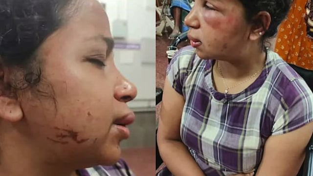 'സ്‌നേഹം പ്രകടിപ്പിച്ച് വീട്ടില്‍ കൊണ്ടുപോയി, തല ഭിത്തിയില്‍ ഇടിച്ചു, മുഖം അടിച്ചുപൊട്ടിച്ചു'; കോട്ടയത്ത് യുവതിക്ക് ക്രൂരമര്‍ദ്ദനം, ഭര്‍ത്താവ് ഒളിവില്‍ 