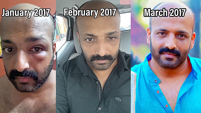 'ഓർക്കുമ്പോൾ ഇപ്പോഴും പേടി തോന്നും, രോഗികളെ പണം കൊയ്യാനുള്ള വെറും ഉപകരണങ്ങളായി മാത്രം കാണുന്ന ഡോക്ടർമാരുണ്ട്';
