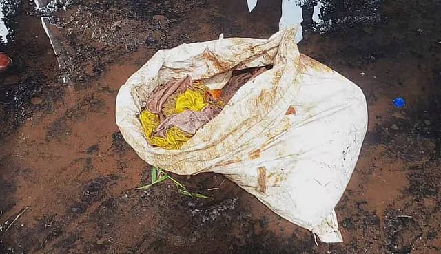 ചൂണ്ടയില് കുടുങ്ങിയത് ചാക്ക്; തുറന്നപ്പോള് തലയോട്ടി; അന്വേഷണം