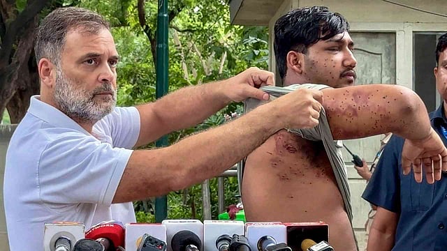 'കേന്ദ്രം നുണ പറയുന്നത് അവസാനിപ്പിക്കണം, ഇന്ത്യയുടെ ഭാവിക്കു നേരെയാണ് അവര് വെടിയുതിര്ത്തത്'; പെല്ലറ്റ് ആക്രമണത്തിന് ഇരയായ വിദ്യാര്ഥിയെ ഒപ്പം നിര്ത്തി രാഹുല് ഗാന്ധി