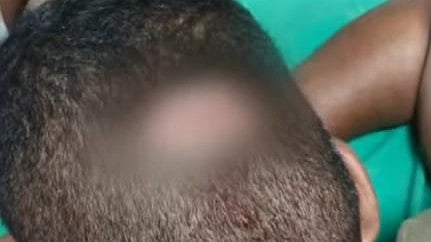 'ഞങ്ങളെ അങ്ങനെ ഒഴിവാക്കാന് നീ ആയോ', ഹെല്മറ്റ് കൊണ്ട് പൊലീസുകാരന്റെ തലയ്ക്കടിച്ചു; സംഭവം ഓണം വാരാഘോഷത്തിന്റെ സമാപന ദിവസം