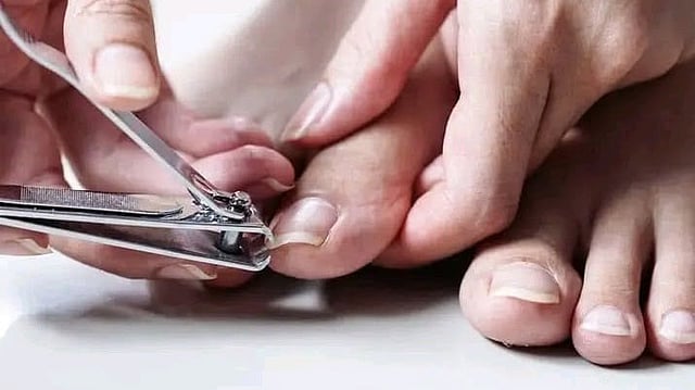 നഖത്തിൽ ഈ മാറ്റങ്ങൾ ശ്രദ്ധിച്ചിട്ടുണ്ടോ? ശരീരം നൽകുന്ന സൂചനകളാകാം