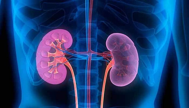 Kidney failure