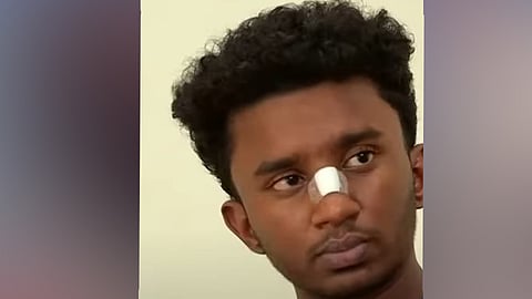 
പരിക്ക് പറ്റിയ അമല്‍
