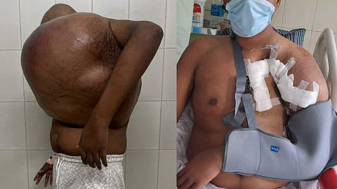 kottayam medical college remove tumor