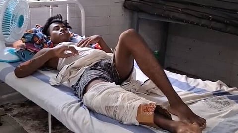 Bihar Health Centre 'Plasters' Man's Fractured Leg With Cardboard