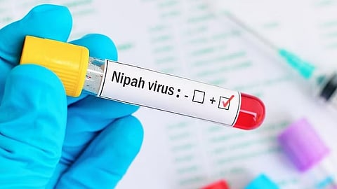 Nipah alert 