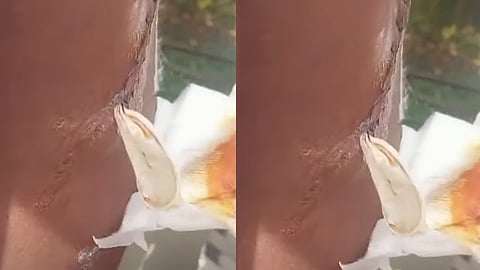 thiruvananthapuram general hospital 