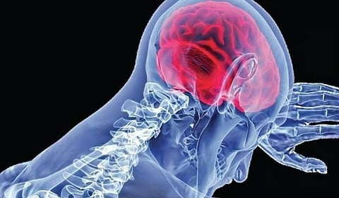  Amebic Meningoencephalitis