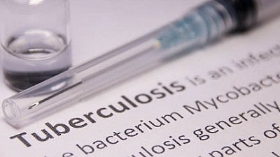 Affordable TB testing technology developed