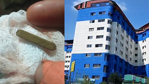 A five-year-old girl got a pencil stuck in her nose; Removed surgically