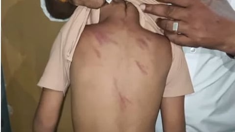 teacher who beat a three-and-a-half-year-old boy was dismissed from her job