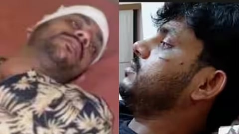 Youth kidnapped, beaten, stripped naked and covered in chilli powder 