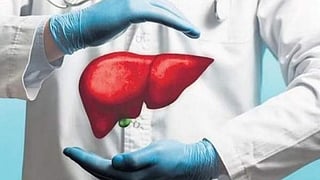 representative image of liver