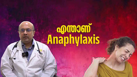 ചികിത്സിച്ചില്ലെങ്കിൽ മരണം വരെ സംഭവിക്കാം, ഏറ്റവും മാരകമായ അലർജി, എന്താണ് അനഫിലാക്സിസ്?