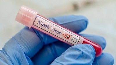 543 people currently on Nipah virus contact list 