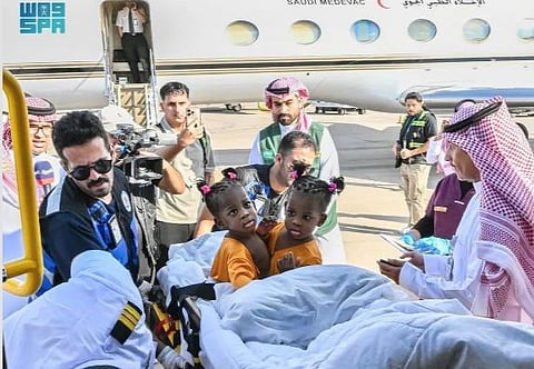 Conjoined Jamaican twins 