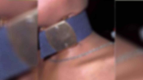 12-year-old boy who got belt stuck in his neck 