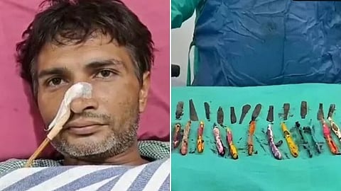 Family Sent UP Man To Rehab. He Got Addicted To Eating Spoons, Toothbrushes