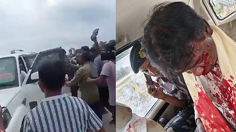 BJP MP Left Bloodied In Attack During Bengal Flood Relief Work